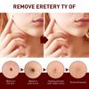 Tags & Moles Remover, WipeOff Tags & Moles Remover, WipeOff Remover 3ML