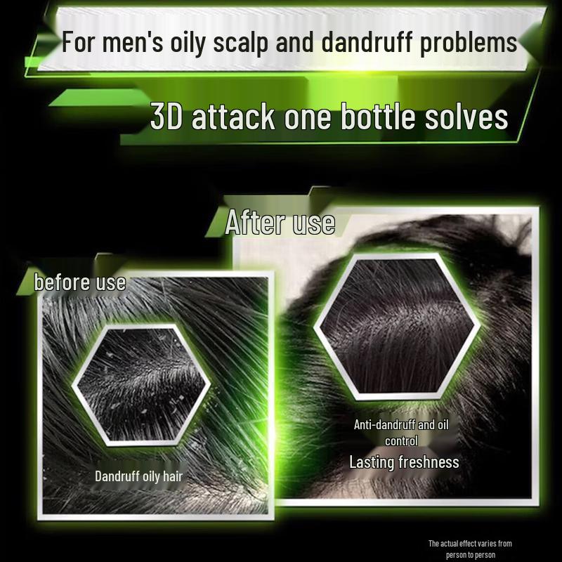 CLEAR Anti-Dandruff Shampoo