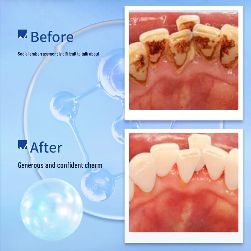 Dr. Dental Stain Removal Whitening Fluoride Toothpaste