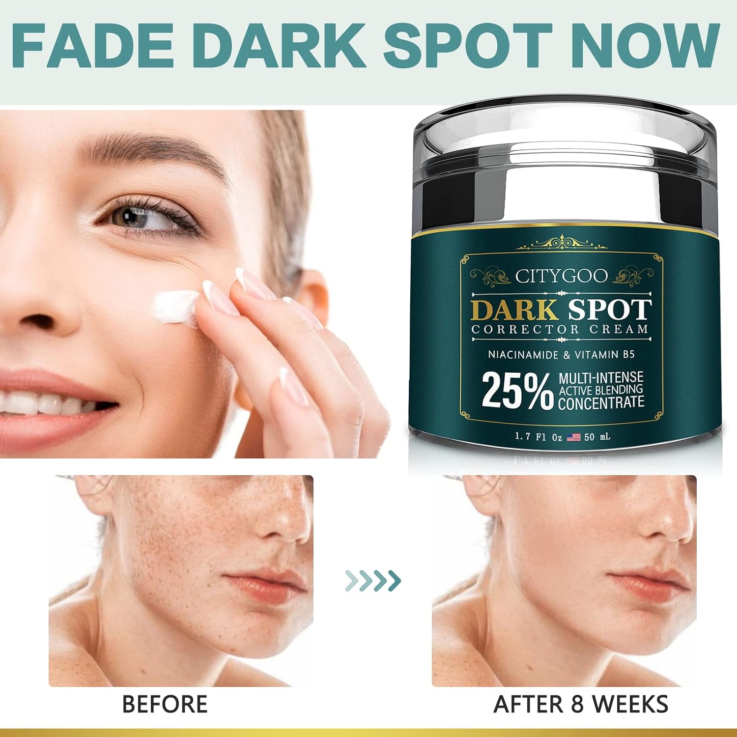 CITYGOO Dark Spot Remover for Face: Dark Spot Corrector Cream - Enriching Skin Care For All Skin Tones - Melasma Freckle Sun Spot Remover & Blemish
