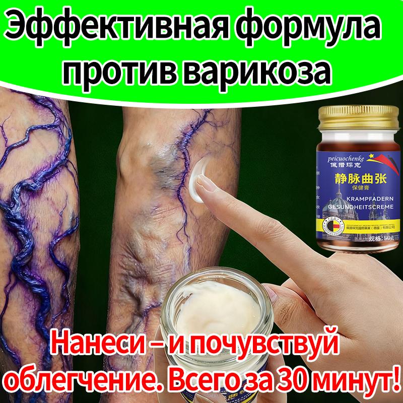 Ointment and cream for varicose veins in the legs!