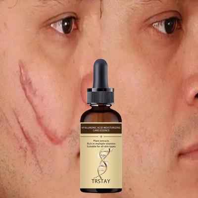 Crema per ferite della pelle Crema per bruciature Crema per sbiadimento Chirurgia Riparazione Cicatrice Cura della pelle Crema sbiancante per la pelle Crema per macchie della pelle