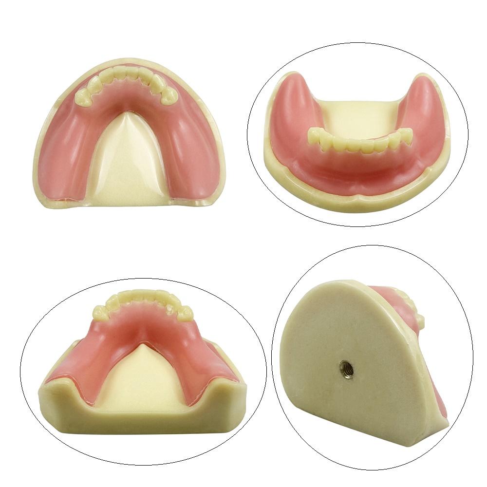 Mandible Maxillary Model For Implant Training Teaching Studying Dentistry Upper Lower Jaws Missing Teeth Implant Practice Model