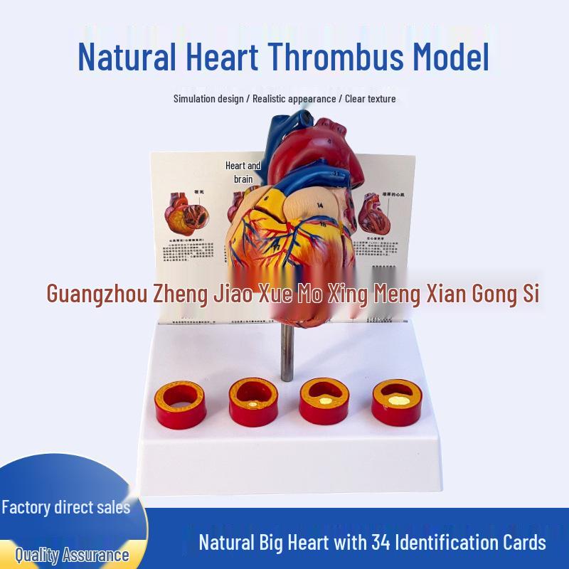 Detachable Large Human Heart Model with Thrombotic Vessel for Anatomical Teaching Adult Natural Large