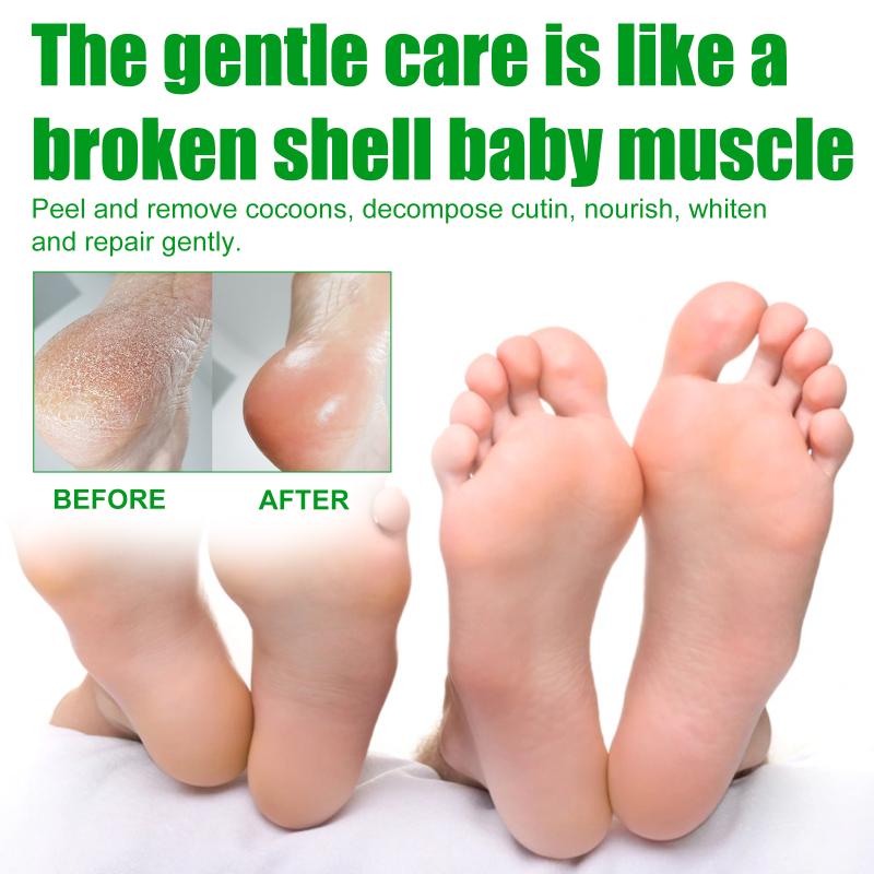 Aloe Vera Feet Mask Moisturizing Exfoliating Feet Mask Anti Drying Crack Remove Dead Skin Hydrating Foot Skin Care Foot Mask