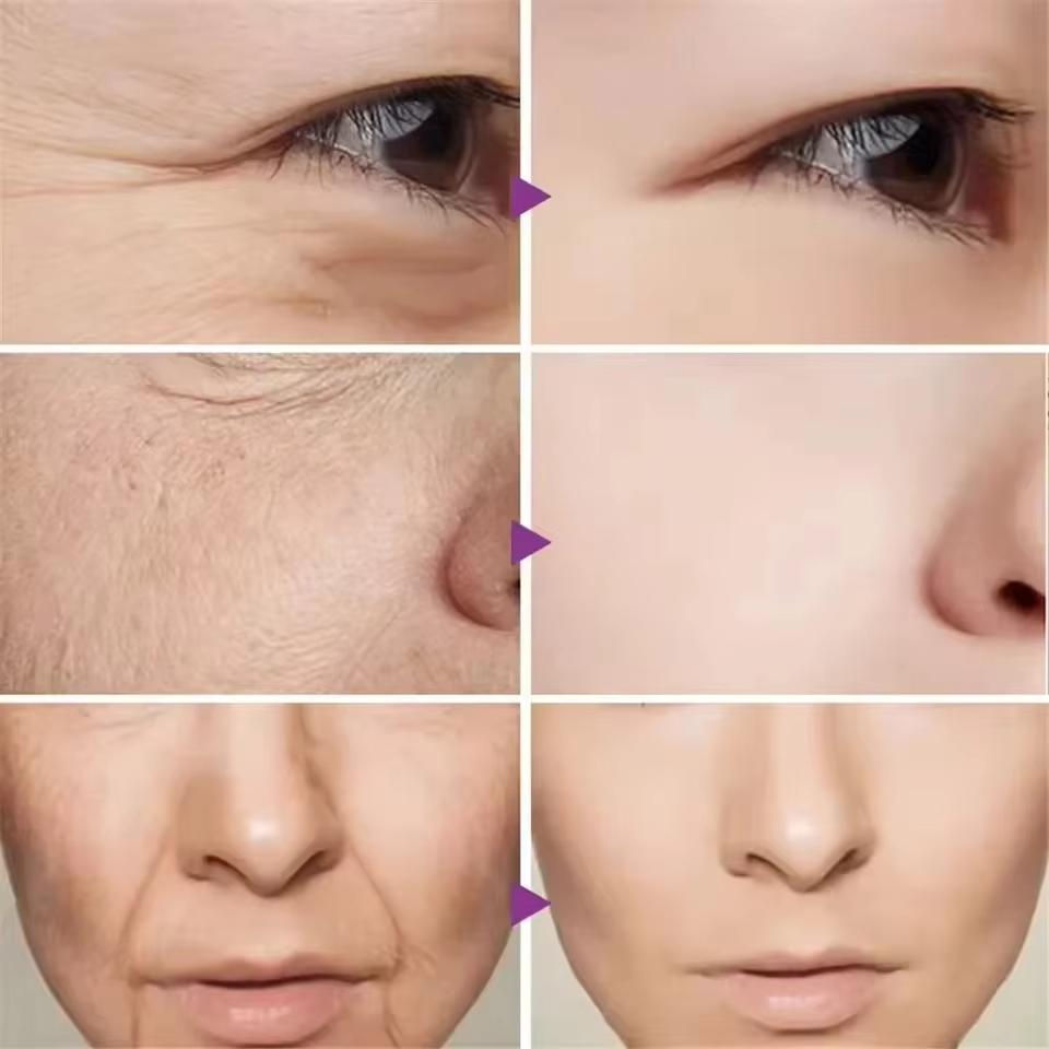 Caviar Anti-Falten-Gesichtscreme, Kollagen, Anti-Aging, straffendes Lifting, verblasst feine Linien, feuchtigkeitsspendend, glatt, aufhellend, Hautpflegeprodukte