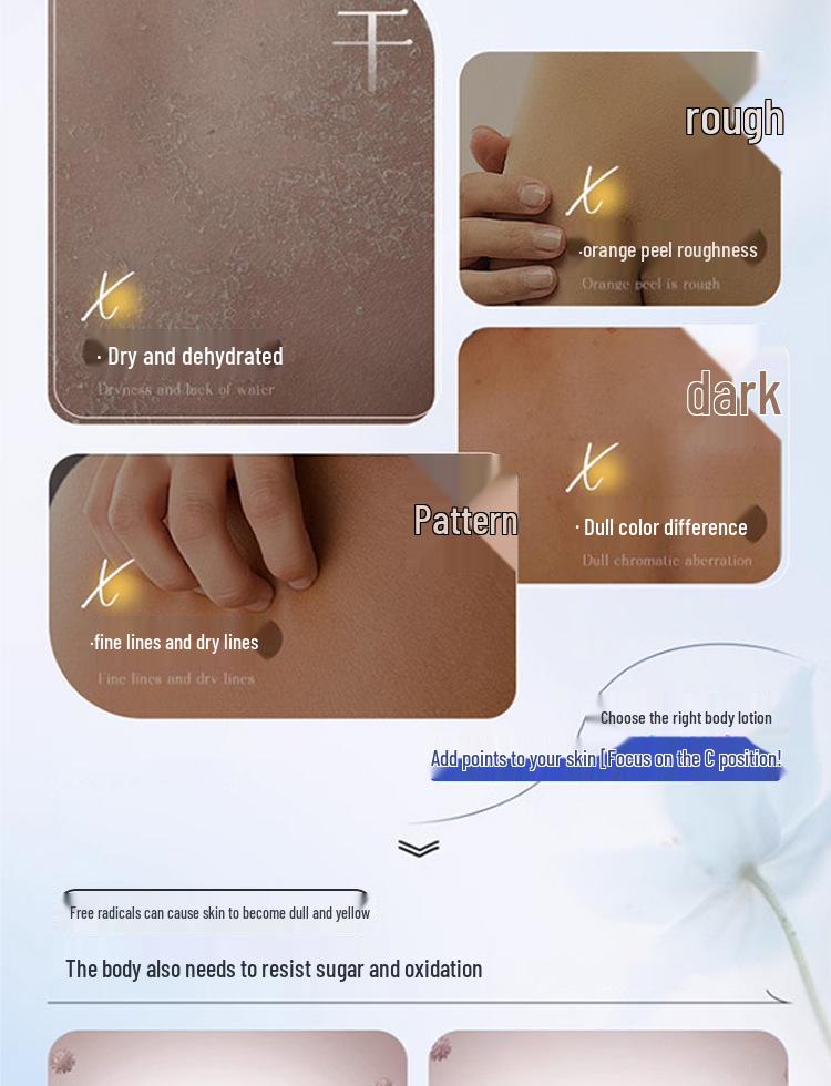 Free Shipping: IRIS FANIDEZ Calamine Soothing Moisturizing Body Lotion 300ml