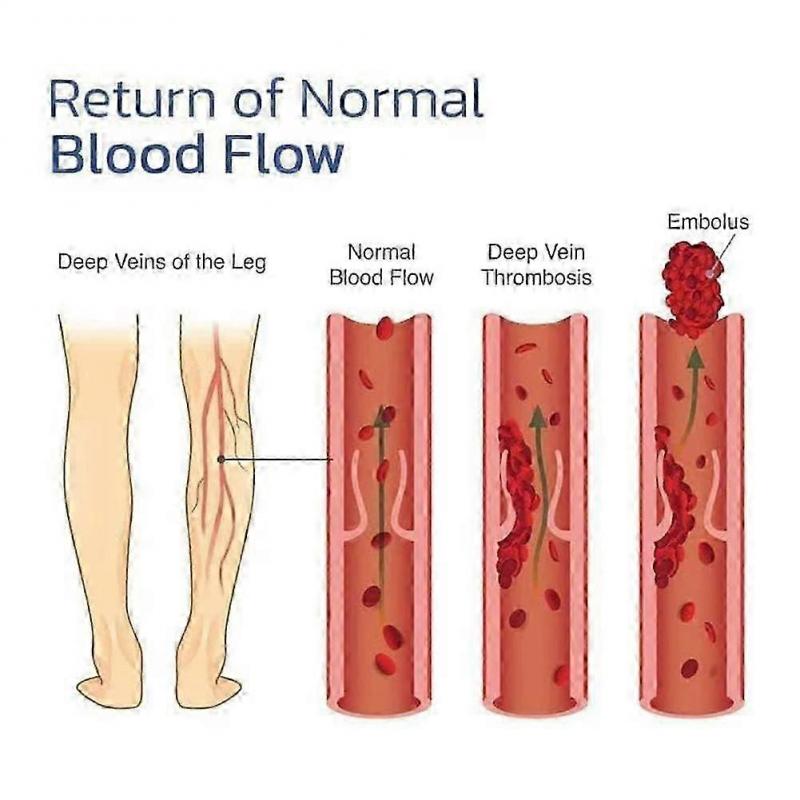 Mugwort Knee Wrap for Self-Heating and Acupressure Support, Thermal Joint Support Knee Sleeve for Arthritis Pain Relief & Warmth Therapy\u200b.