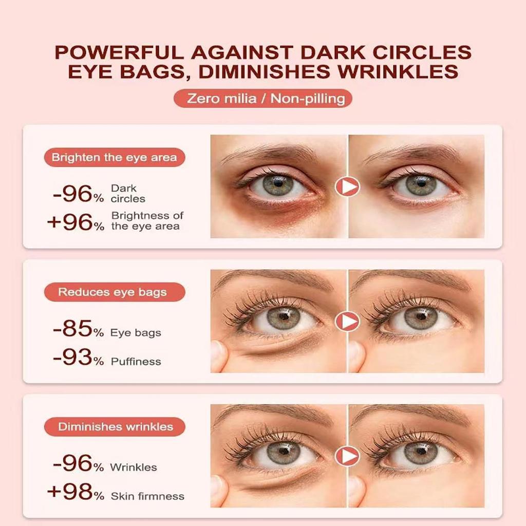 Reduces the Appearance of Dark Circles Around the Eyes, Removes Wrinkles, Tightens Wrinkles and Fine Lines, Moisturizes and Hydrates