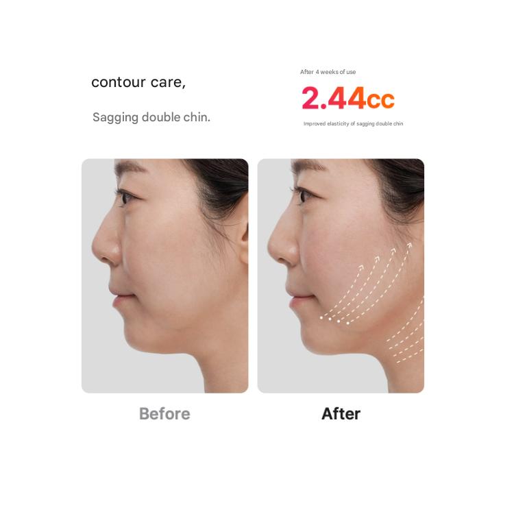 Medicube [Collagen RF] Ultra Tune 40.68