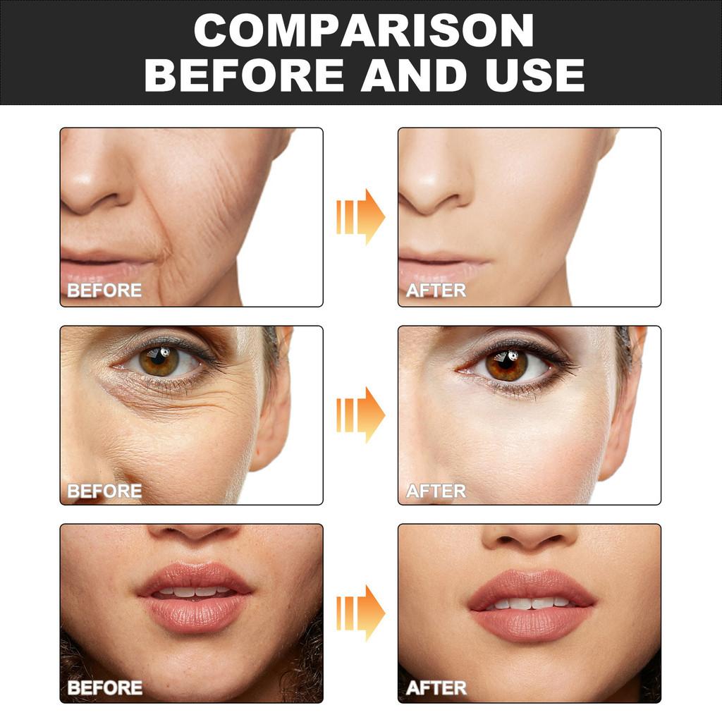 Eelhoe Collagen Water Soluble Face Cheek Patches For Wrinkle Reduction And Hydration