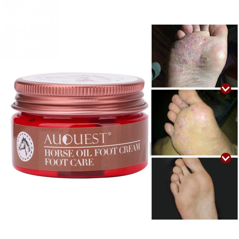 30g Feet Cilt Bakım Kremi Kaşıntı Önleyici Antifungal Anti Crack