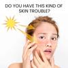 Limited time!!Eelhoe Protective Moisturizing Cream: Sun Protection, Refreshing And Nourishing Body Skin Protection Cream