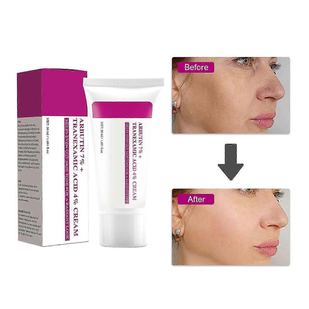 3pcs Arbutin 7% Tranexamic Acid 4% Cream, 50ml K-Beauty Brightening Firming Skin Tone Corrector