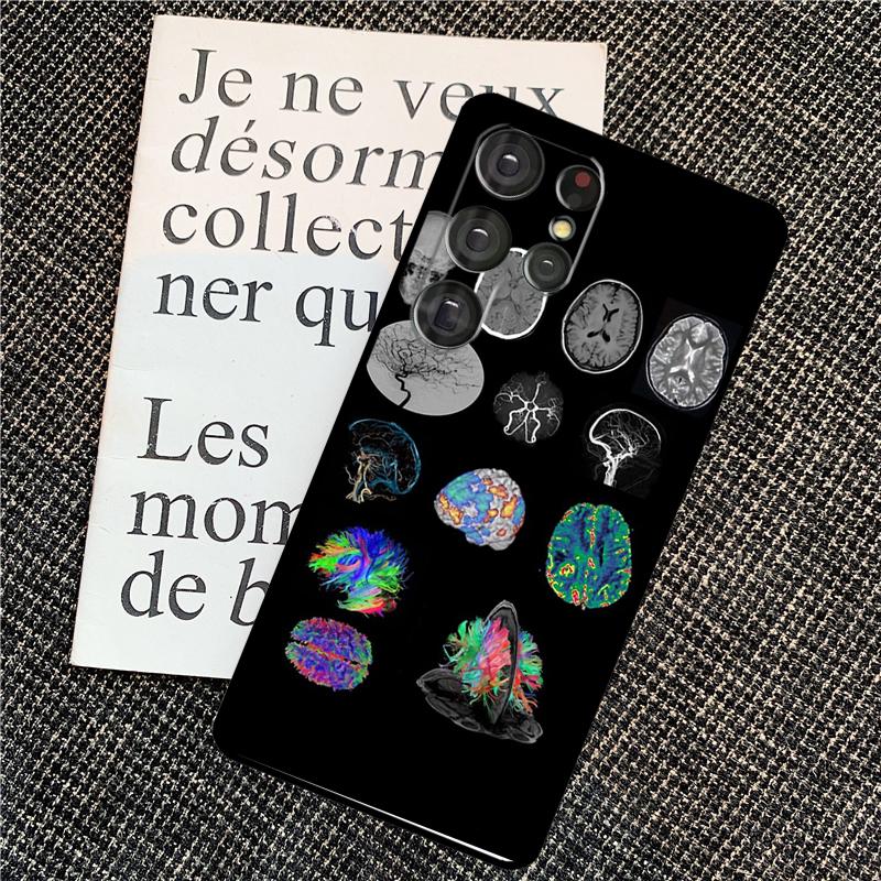 Anatomy Brain Case For Samsung Galaxy S25 Ultra S20 S21 S22 S23 S24 Ultra S9 S10 Plus S24 FE Back Cover