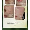 Acne Mask Sensitive Muscle Soothing Moisturizing Multi-acid Mild Oil Control Acne-removing Pore Blackhead Patch