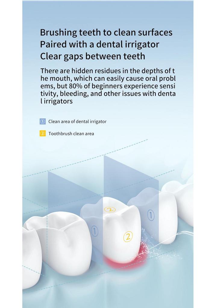 Portable High-Pressure Oral Irrigator for Effective Dental Calculus Removal
