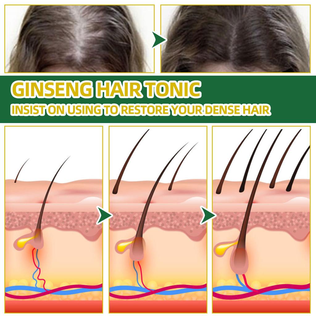 Ginseng Hair Growth Lotion Ginseng Essence Moisturizes Hair Prevents Hair Loss  Firms Hair Hair Growth Spray