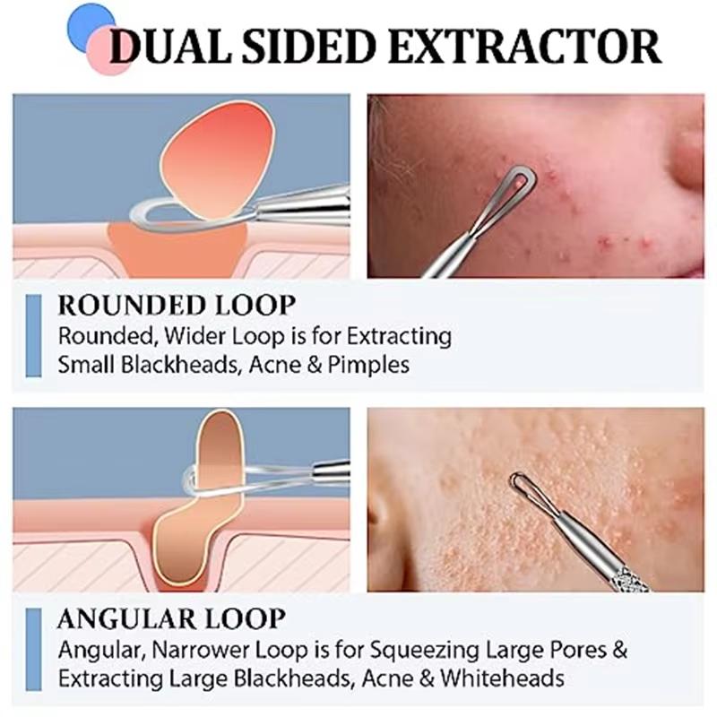 4/8Pcs Ultra-Precise Pimple Tweezers Set - Pro Acne and Blackhead Removal Tool -for Effective Face Care and Skin Purification