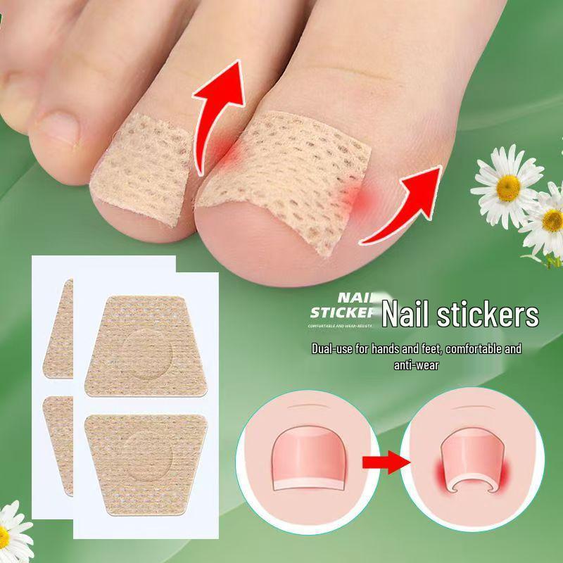 Ochranná náplast na zarostlý nehet: Jemná péče o nehtové lůžko a onychomykózu