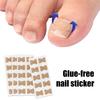 20Pcs Ingrown Toenails Correction Patches Breathable Painless Ingrown Toenail Treatment Tool Professional Ingrown Toenail Straightener Corrector