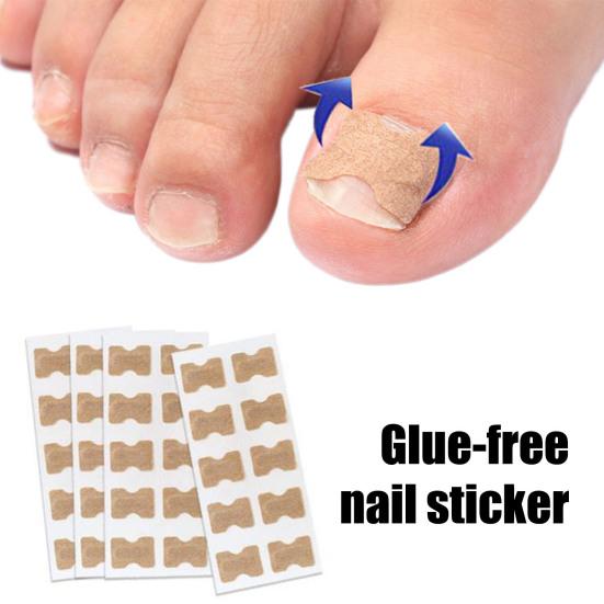 20Pcs Ingrown Toenails Correction Patches Breathable Painless Ingrown Toenail Treatment Tool Ingrown Toenail Straightener Corrector Strips