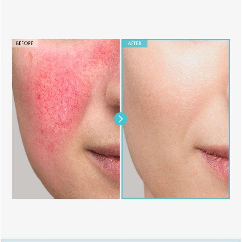 TOSOWOONG SOS Repair Cica Clinic Zinc Oxide 10% Cream 50g