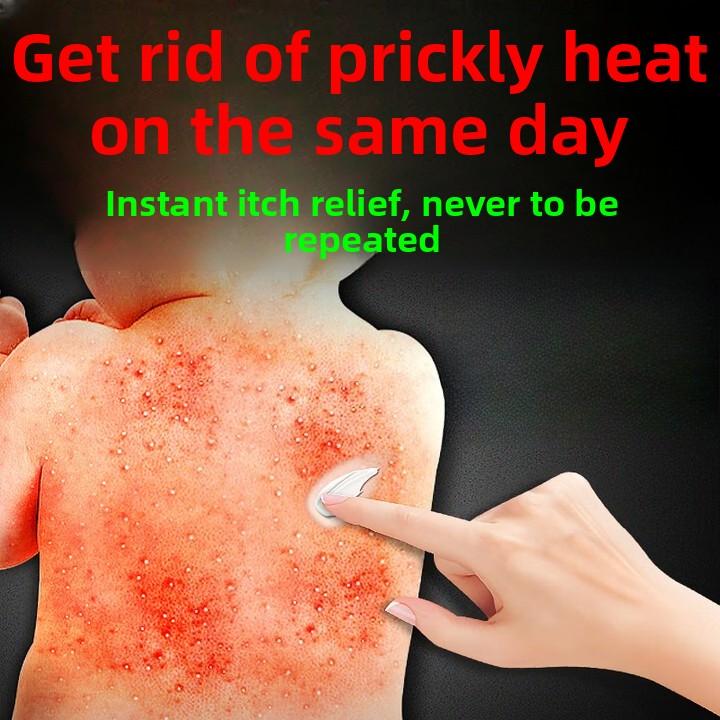 Itch Relief Fast! Anti-Itch Cream for Urticaria & Skin Allergies - Soothes Hives, Rashes On Body, 50g