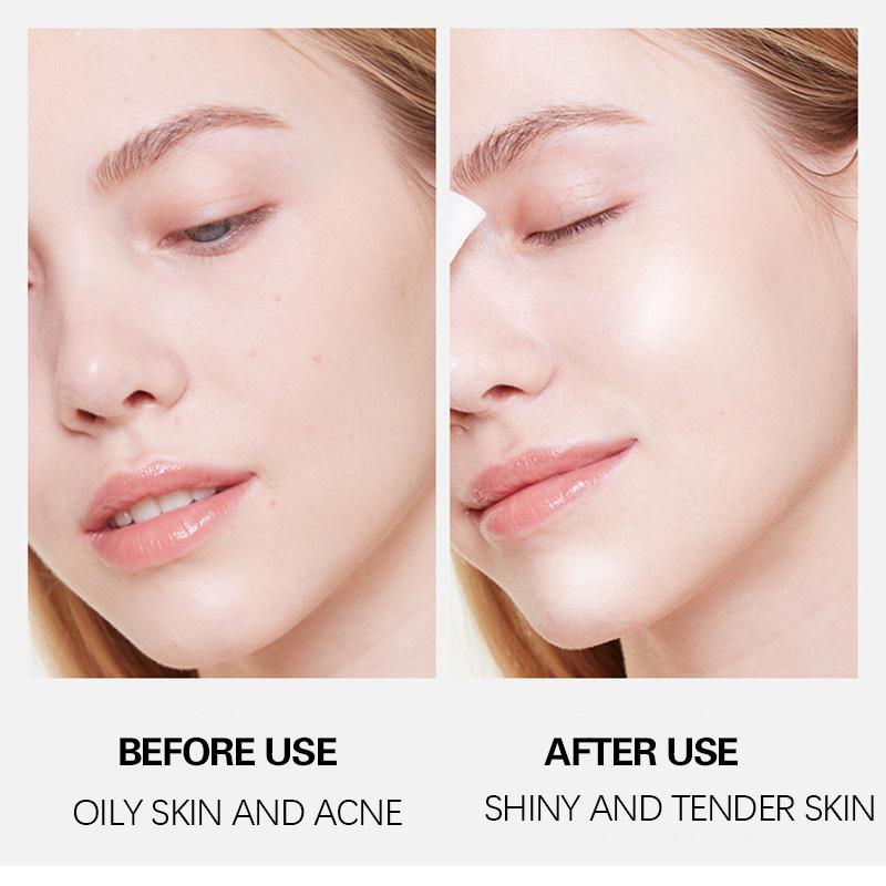 Krém na obličej Přírodní intimní pleť Exfoliační bělení Odstraňuje Redukuje skvrny Hydratuje Zjemňuje Vyhlazuje Péče