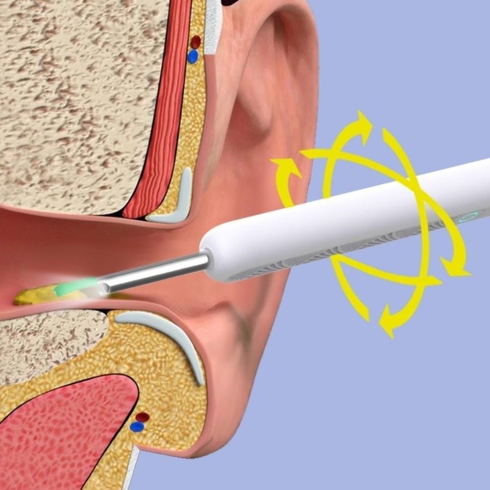 HD Camera Ear Cleaner Full Set Smart Ear Wax Removal Tools Ear Cleaning Tools  Oral Inspection