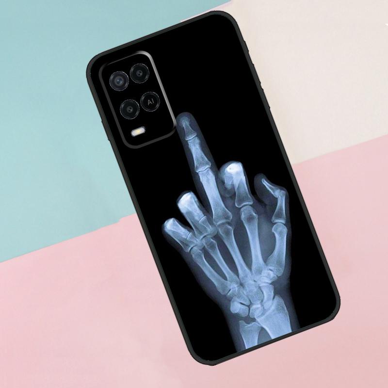 

Middle Finger Skeleton Skull Bone For Oppo A18 A38 A78 A98 A96 A58 A17 A77 A80 A40 A60 A16 A76 A74 A94 A54 A15 A57S Phone Case OPPO A94 4G