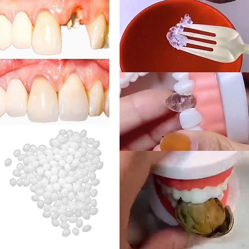 10G/15G/20G Temporary Tooth Repair Kit Teeth And Gaps False Teeth Solid Glue Denture Adhesive Teeth Whitening Tooth Beauty Tools