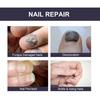 OUHOE Nail Repair Essence Soft Nail Thickening Nail Smoothing Endogenous toenail Nail Fungus Repair Essence