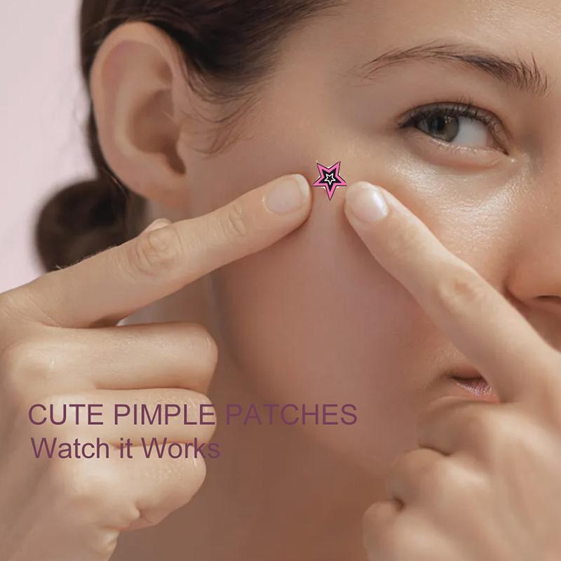 300Pcs Star Acne Patch Repair Acne Cleansing Invisible Breathable Waterproof Acne Cleansing Concealer Fade Clean