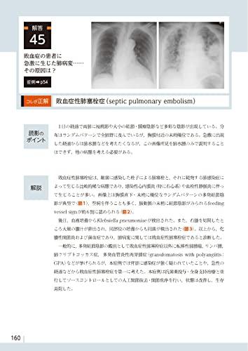 Diagnostic Imaging Dojo Updated Edition <Chest Edition>
