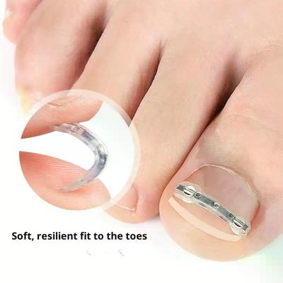 Ingrown Toenail Corrector Tools Pedicure Recover Embed Toe Nail Treatment Professional Ingrown Toenail Straightening Clip Brace