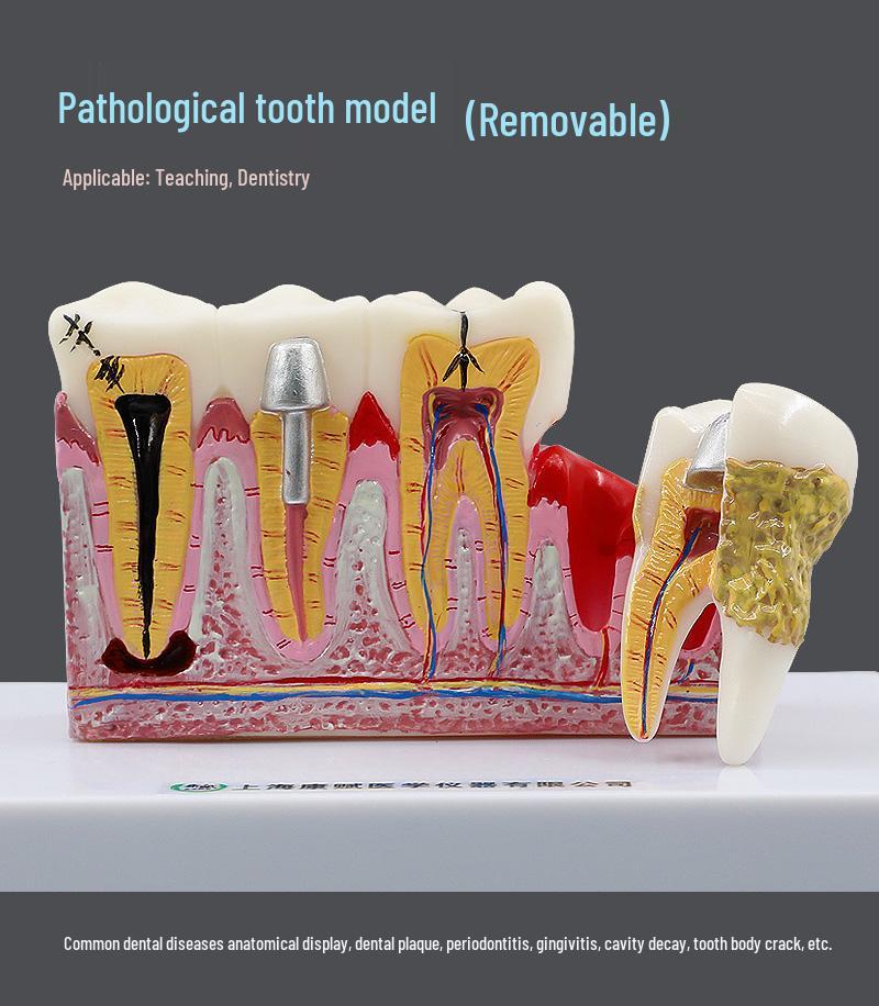 

Children s Dental Education Tooth Model for Kindergarten