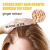 3PC Ginger Shampoo Soap Hair Loss Prevention Softening Solid Hair Repair Dry and