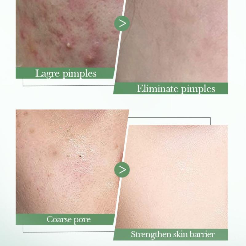 Salicylic Acid Nourishing Essence Milk SADOER Moisturizing Hydrating Refreshing Water Milk