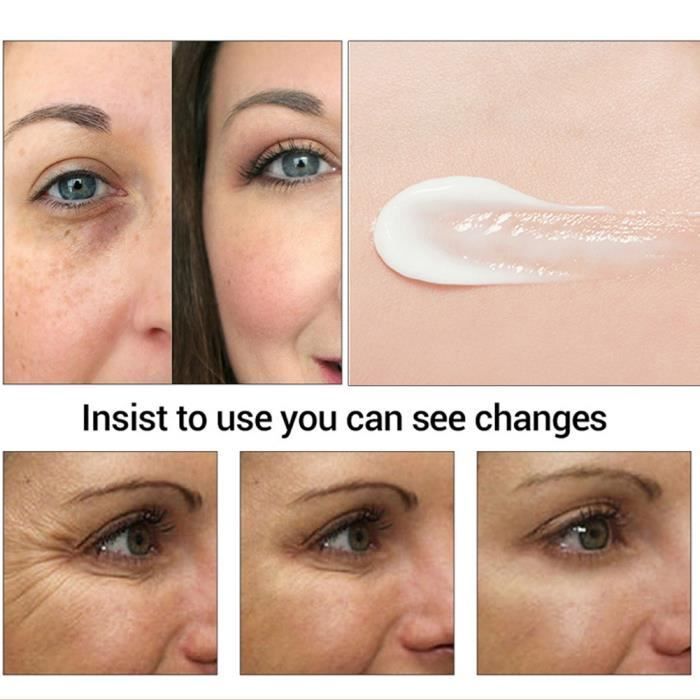 Crème Pour Les Yeux - KEENSO - Anti-rides - 2 Pièces - 25 Ml - Vitamine C