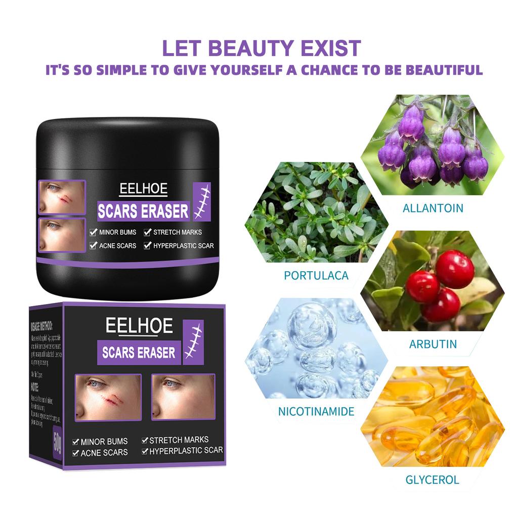 EELHOE Scar Removal Cream Gel Remove Acne Spots Treatment Stretch Marks Burn Surgical Scar Repair Cream Smoothing Whitening Skin Beauty 50g
