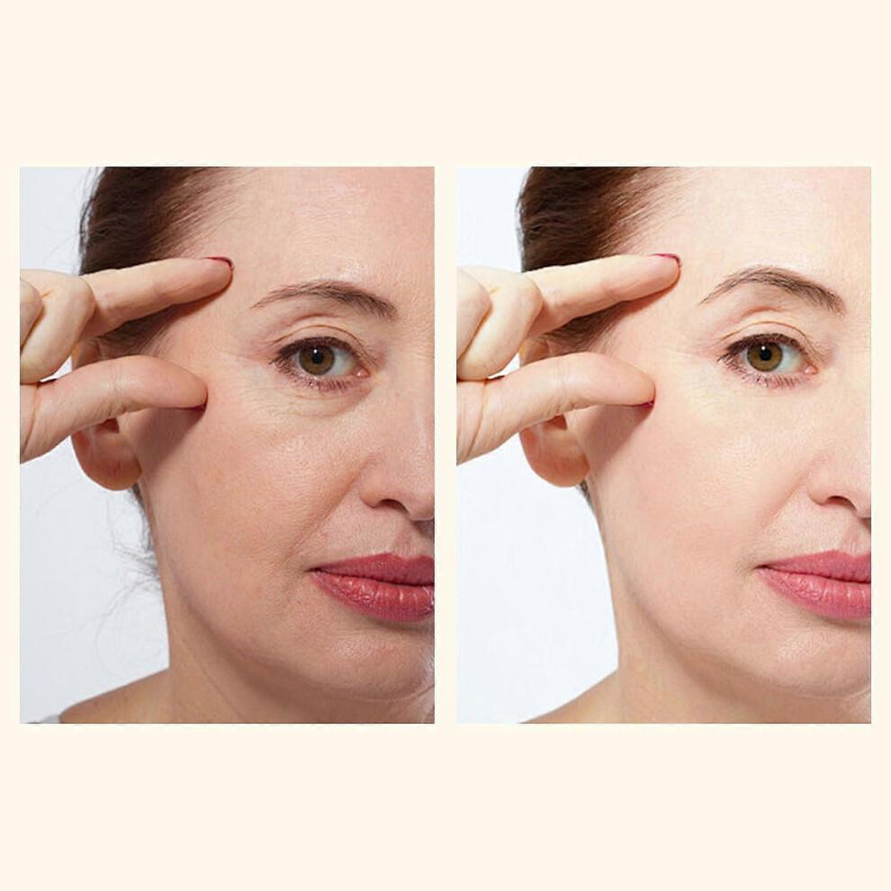 45% Citric Acid Skin-Renewing Serum  Anti-Ageing, Brightening, Spot-Reducing, AHA Peel Treatment Serum