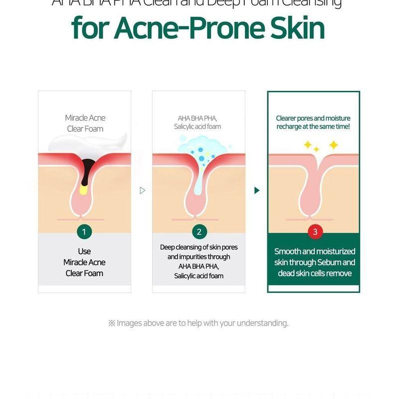 SOME BY MI - AHA,BHA,PHA 30 Days Miracle Acne Clear Foam Mini