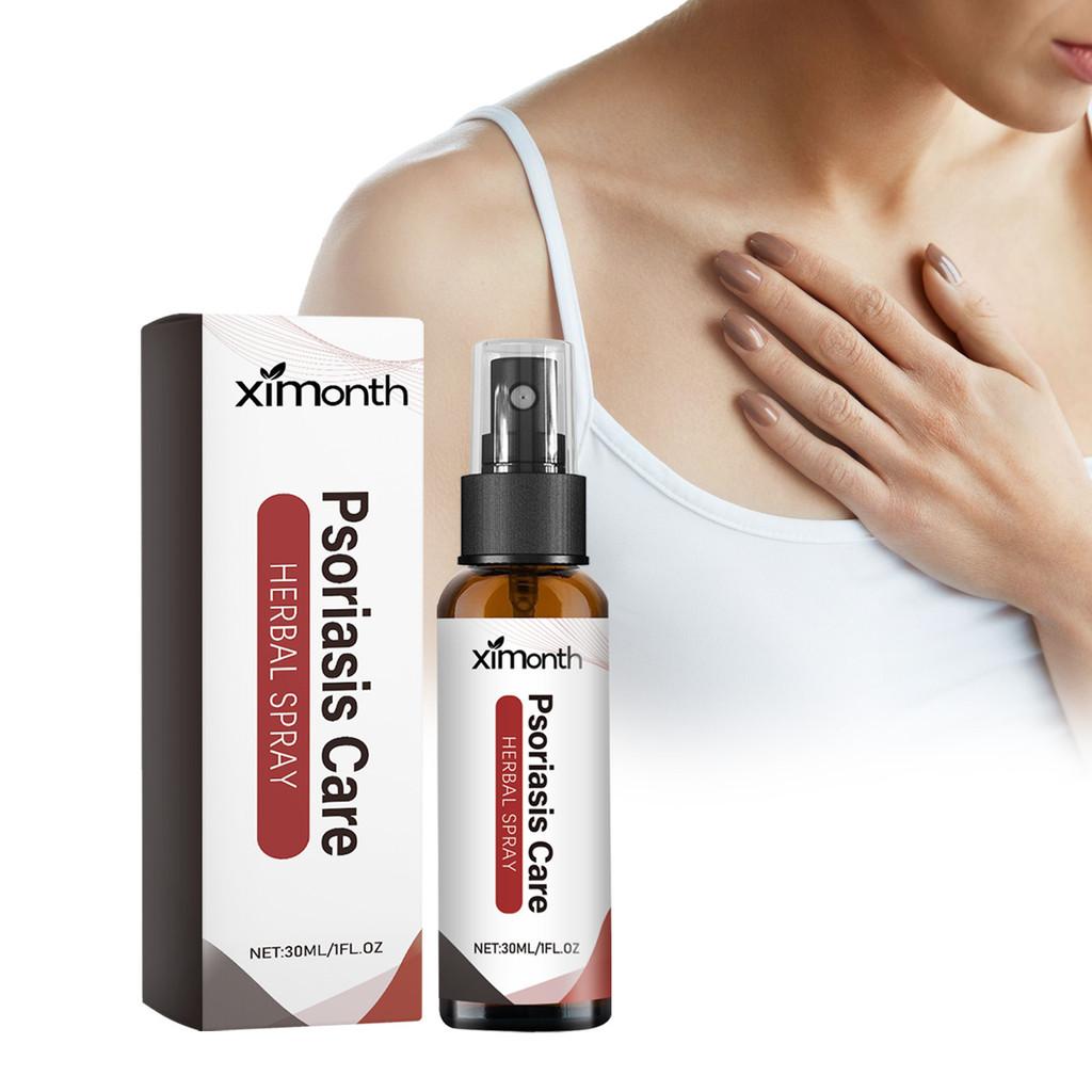 Ximonth Skin Repair Spray Soothing Hydrating Relief For Itchy Red Skin Moisturizer