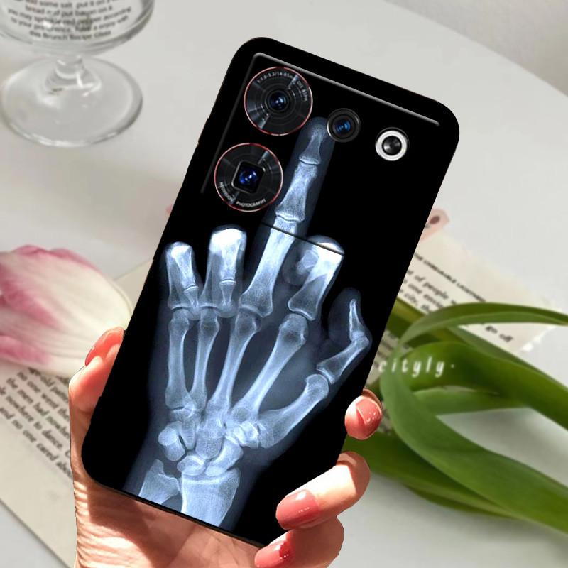 Case For ZTE Nubia Z50 Ultra Case Soft Print Silicone TPU Black Bumper Cover For ZTE Nubia Z60 Ultra Phone Back Coque z50Ultra