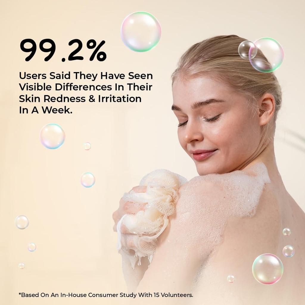 Sunny Herbals Derm Aid Soap 75 gm X Pack of 6 | Soothes Dry Skin & Calms Irritation with Herbal Care