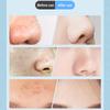 Multi Speed Pore Vacuum Cleaning Blackhead Remover For Face With Intelligent Suction Control And Reusable Tips