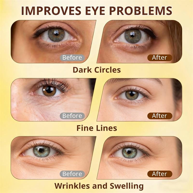 Caffeine Eye Cream Anti-Wrinkle Dark Circle Reducer Puffy Eye Bag Cream Niacinamide Eye Serum 20 ml for Men Women