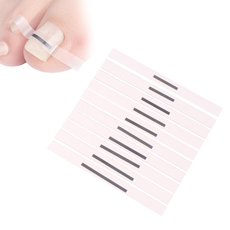 1Pcs Toenail Straightening Clip Ingrown Toenail Correction Tool Nail Treatment Elastic Patch Sticker Foot Care Pedicure