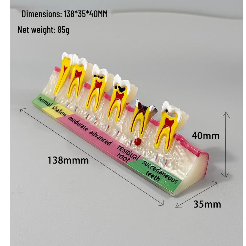 Прозора Знімна Повна Модель Щелепи з М'якими Яснами та Зубами для Підготовки до Імплантації